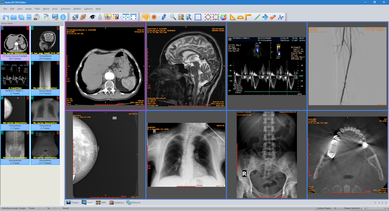 Software To View Ct Scan On Mac